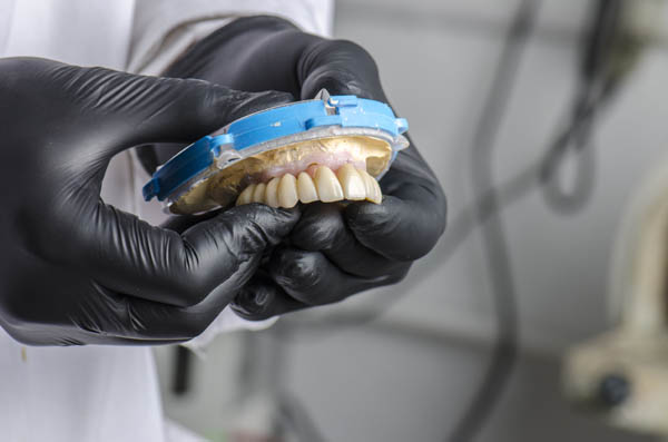 Implant Supported Dentures Gibbsboro, NJ